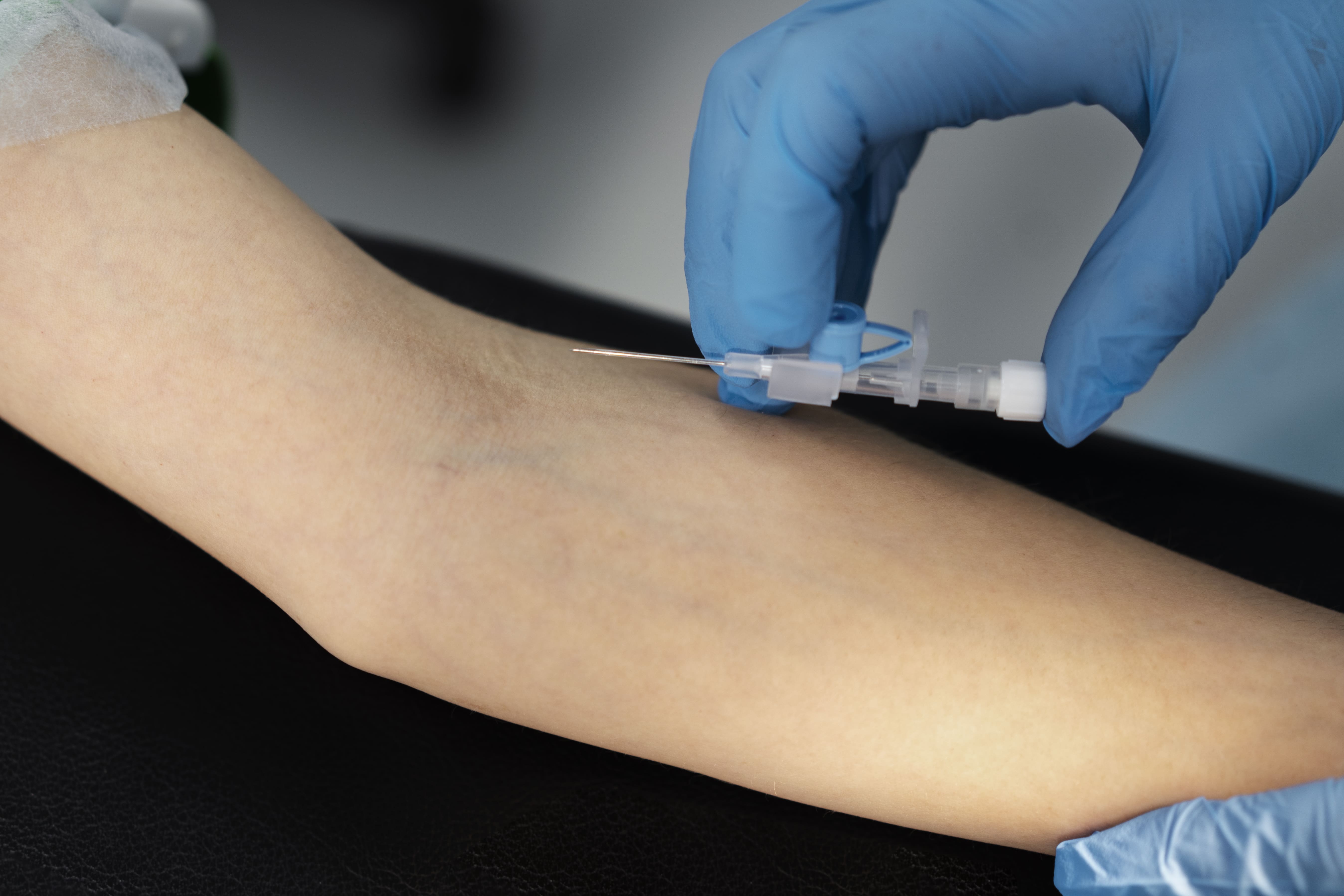 Vascular Access